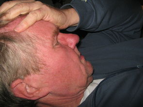 孕妇妊娠合并软组织肉瘤怎么手术？